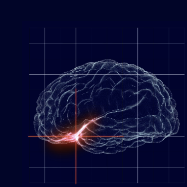 NeuroOne Raising $12M in Stock Sale