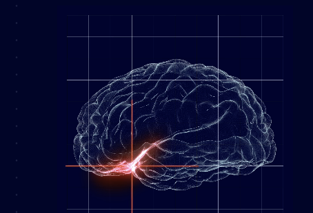 NeuroOne Raising $12M in Stock Sale