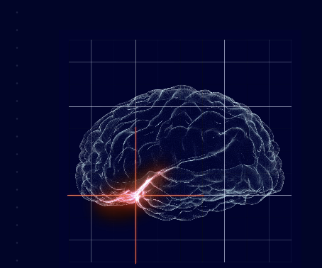 NeuroOne Raising $12M in Stock Sale