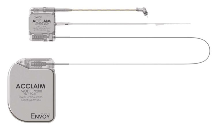 Minnesota-Made Cochlear Implant Gets a Trial Run at Mayo