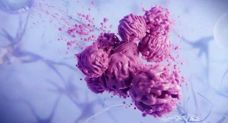 Alpheus Medical Raises $14M, Starts Clinical Trial