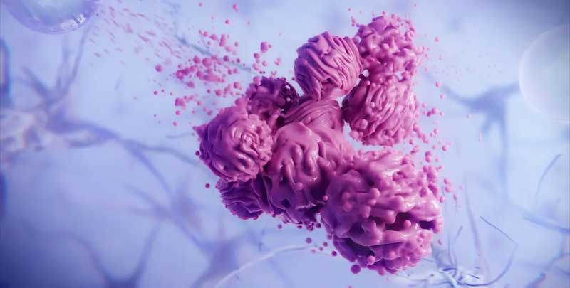 Alpheus Medical Raises $14M, Starts Clinical Trial