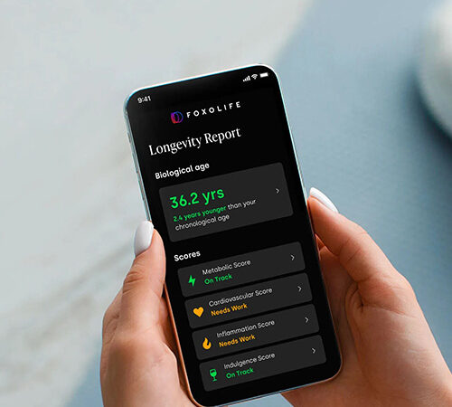 Foxo Technologies Faces Delisting on NYSE