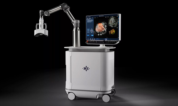 HistoSonics Targets Pancreatic Tumors in New Feasibility Study