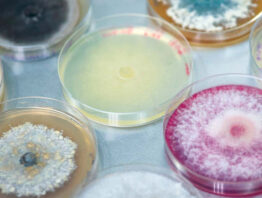 petri dishes holding microbes owned by St. Paul-based Jord BioScience