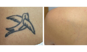 Cleo-before and after