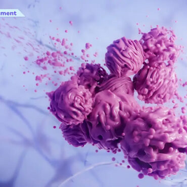 Alpheus Medical Lands $52M for Novel Brain Cancer Treatment