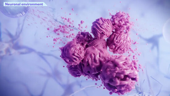 Alpheus Medical Lands $52M for Novel Brain Cancer Treatment
