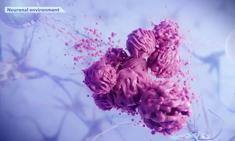 Alpheus Medical Lands $52M for Novel Brain Cancer Treatment