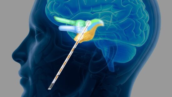 Eden Prairie Company Expands Med Tech Use to Chronic Pain Disorder