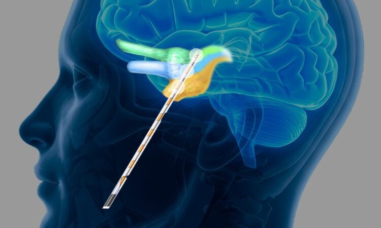 Eden Prairie Company Expands Med Tech Use to Chronic Pain Disorder