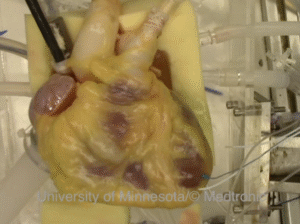 Researchers reanimates multiple human hearts a month inside the Visual Heart Lab at the University of Minnesota.